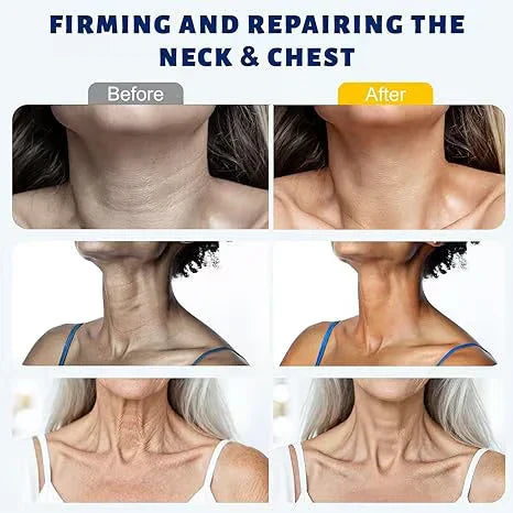 Getsylvoria™ 5-Roller Neck Firming Cream – Collagen & Hyaluronic Acid for Smoother, Tighter-Looking Neck Skin