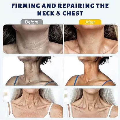 Getsylvoria™ 5-Roller Neck Firming Cream – Collagen & Hyaluronic Acid for Smoother, Tighter-Looking Neck Skin