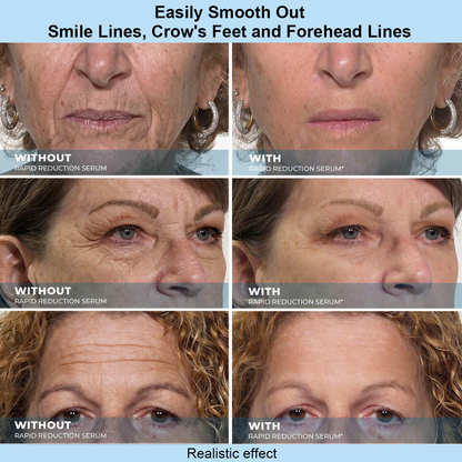 Getsylvoria™ Instant Face Temporary Tightener – Instant visible results in 60 seconds
