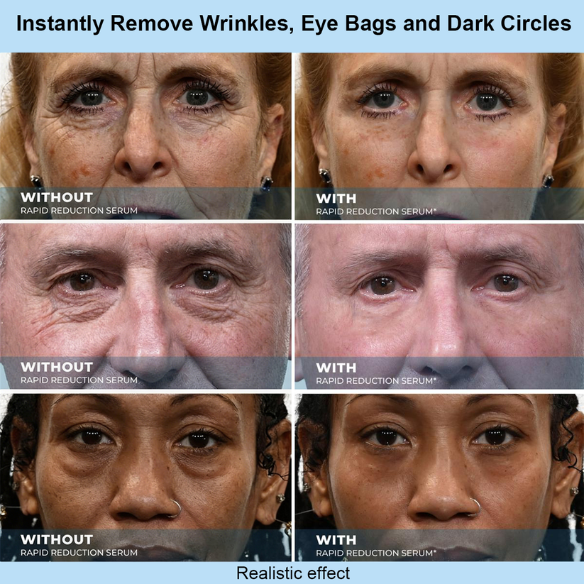 Getsylvoria™ Instant Face Temporary Tightener – Instant visible results in 60 seconds